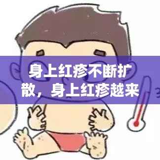 身上红疹不断扩散,身上红疹越来越多