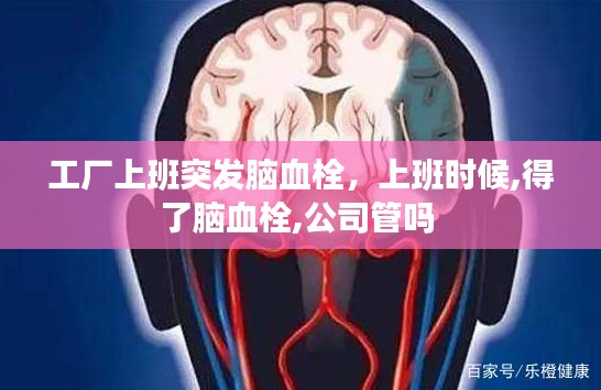 工厂上班突发脑血栓,上班时候,得了脑血栓,公司管吗